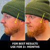 Advanced Growth Kit
