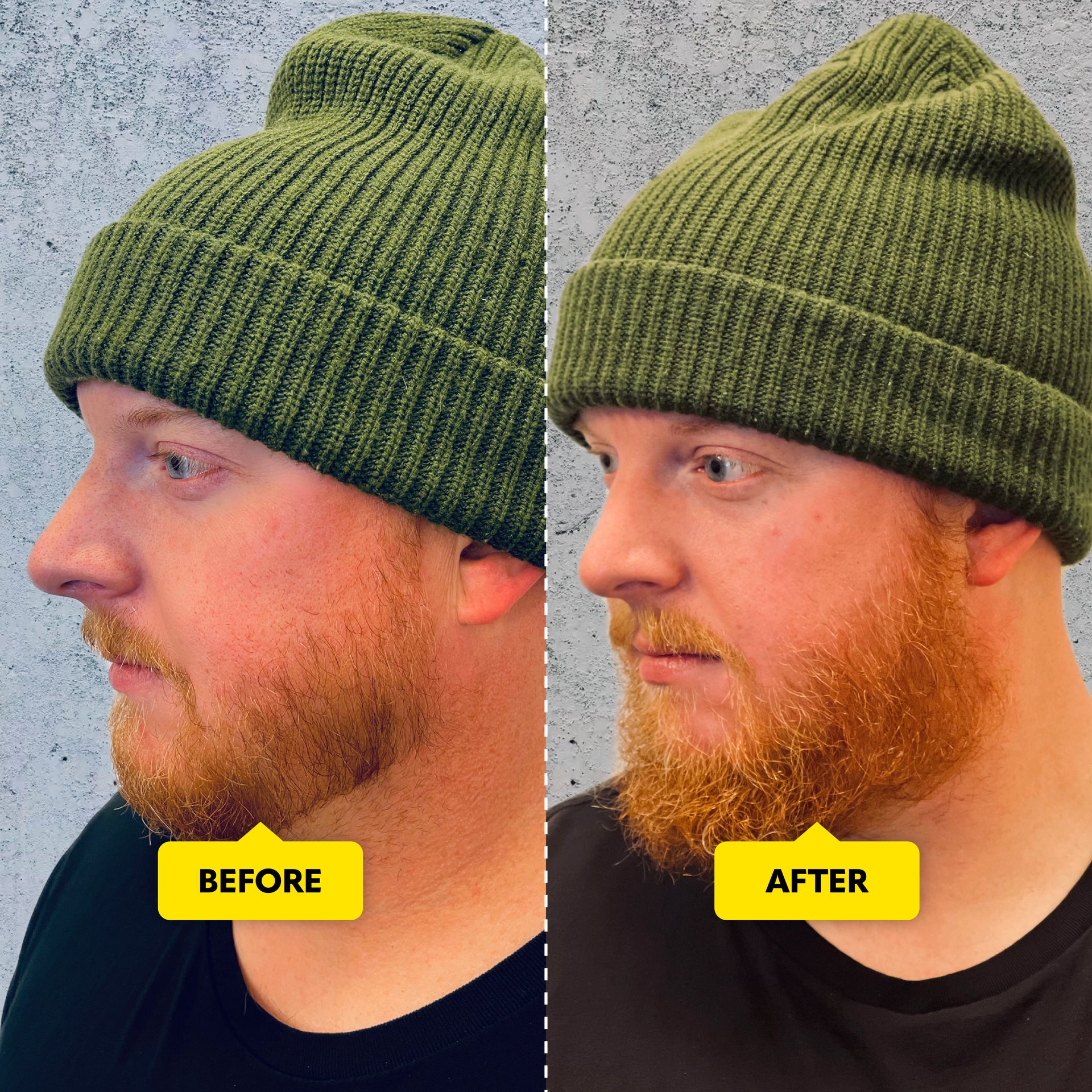 Beard Growth Oil