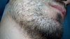 How to Grow a Beard In 3 Weeks