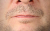 How To Fix Patchy Beard: 7 Ways To Improve Uneven Beard Growth