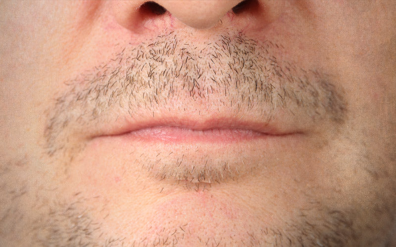 How To Fix Patchy Beard: 7 Ways To Improve Uneven Beard Growth