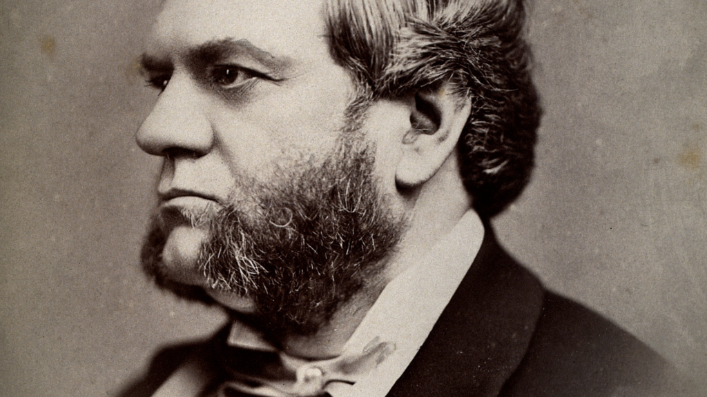 Man with muttonchops beard